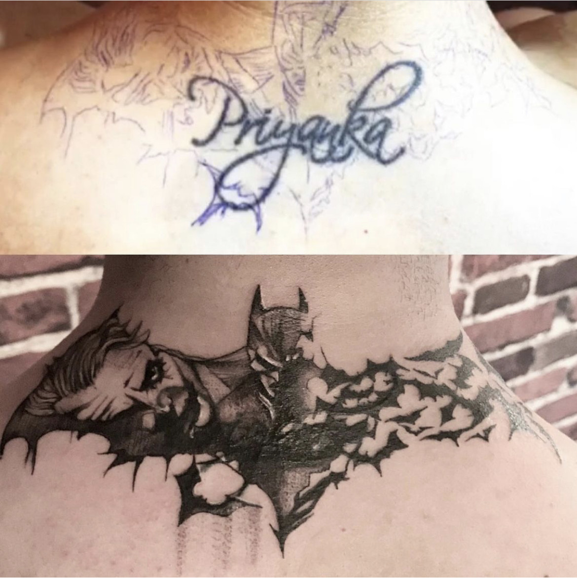 Cover up or tattoo removal and scars coverup