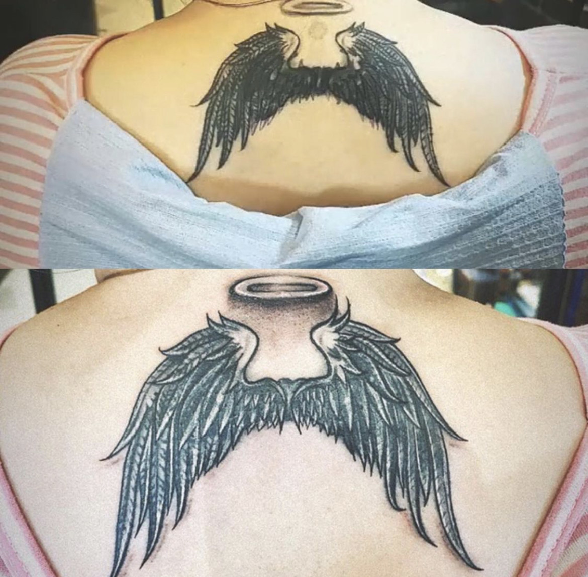 Cover up or tattoo removal and scars coverup