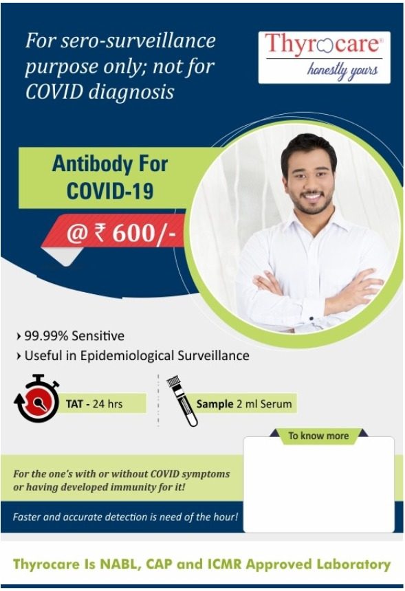 Covid Antibody IgG