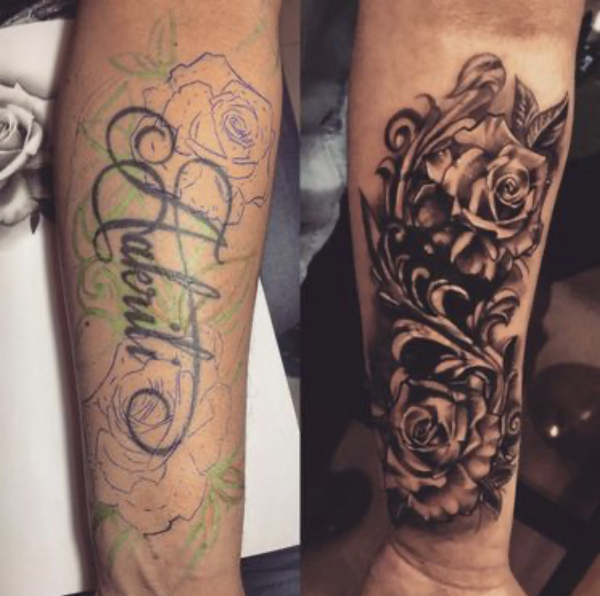 Cover up or tattoo removal and scars coverup