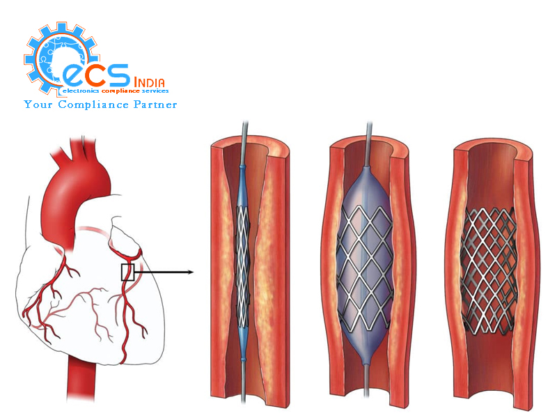 Cardiac Stents