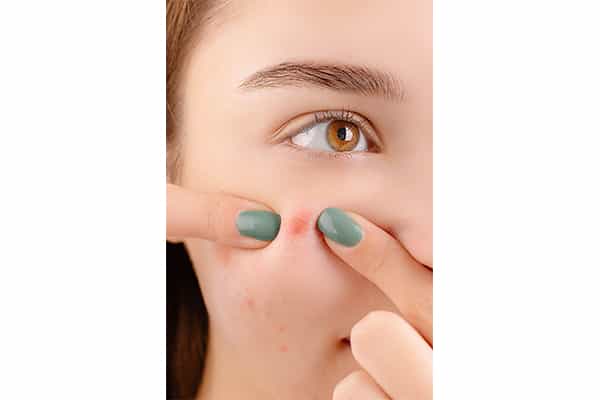 Dark Spots Treatment