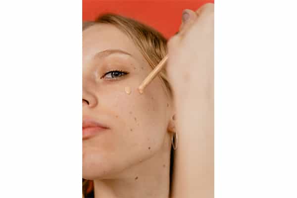 Uneven Skin Tone Treatment