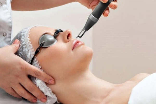 Laser Pigmentation Removal