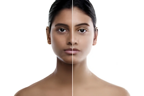 Skin Brightening Treatment