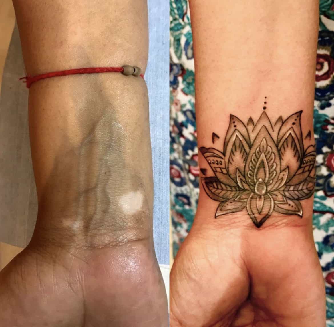 Scar Cover up Tattoo