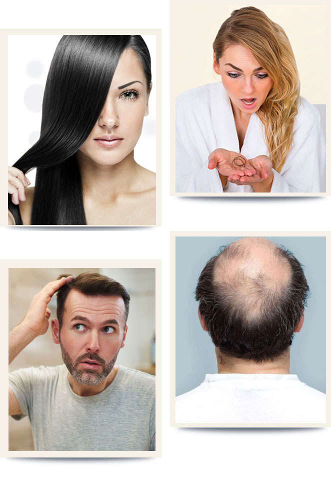 Regain Natural Hair with PRP Hair LossFall Treatments Noida Uttar  Pradesh India