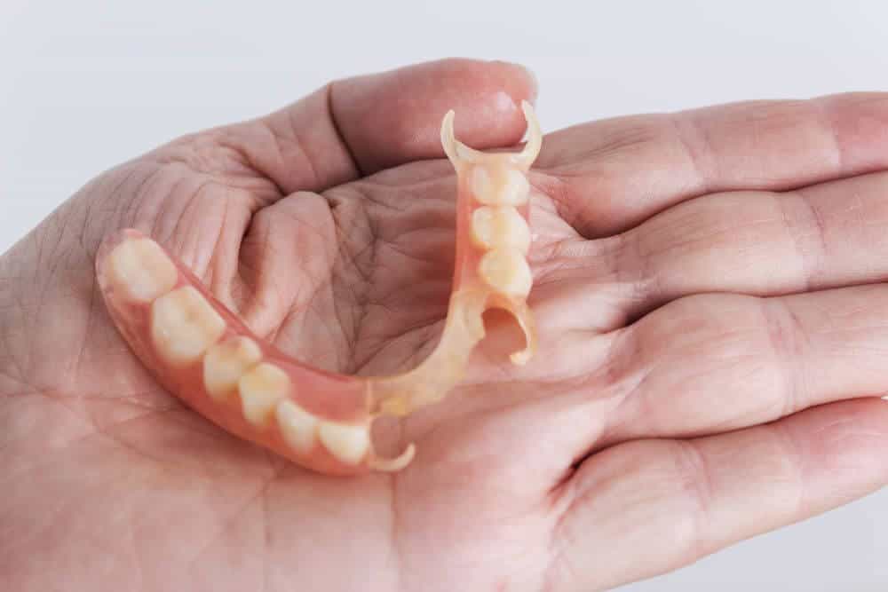 Partial Dentures