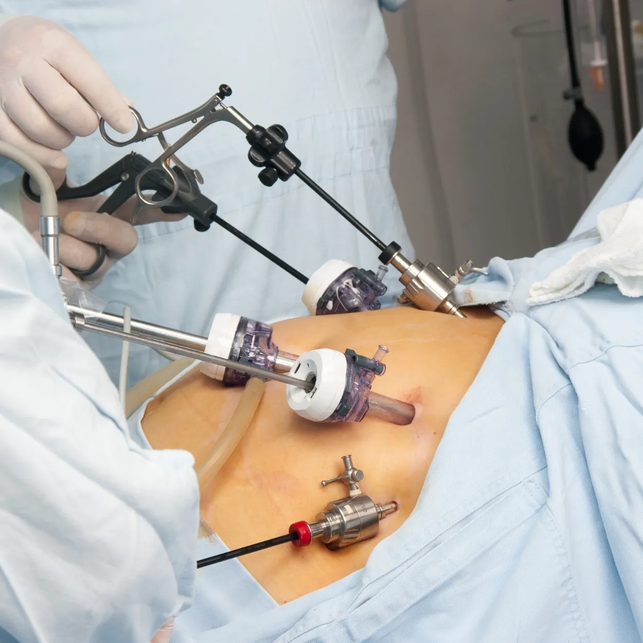 Bariatric & Metabolic Surgeries