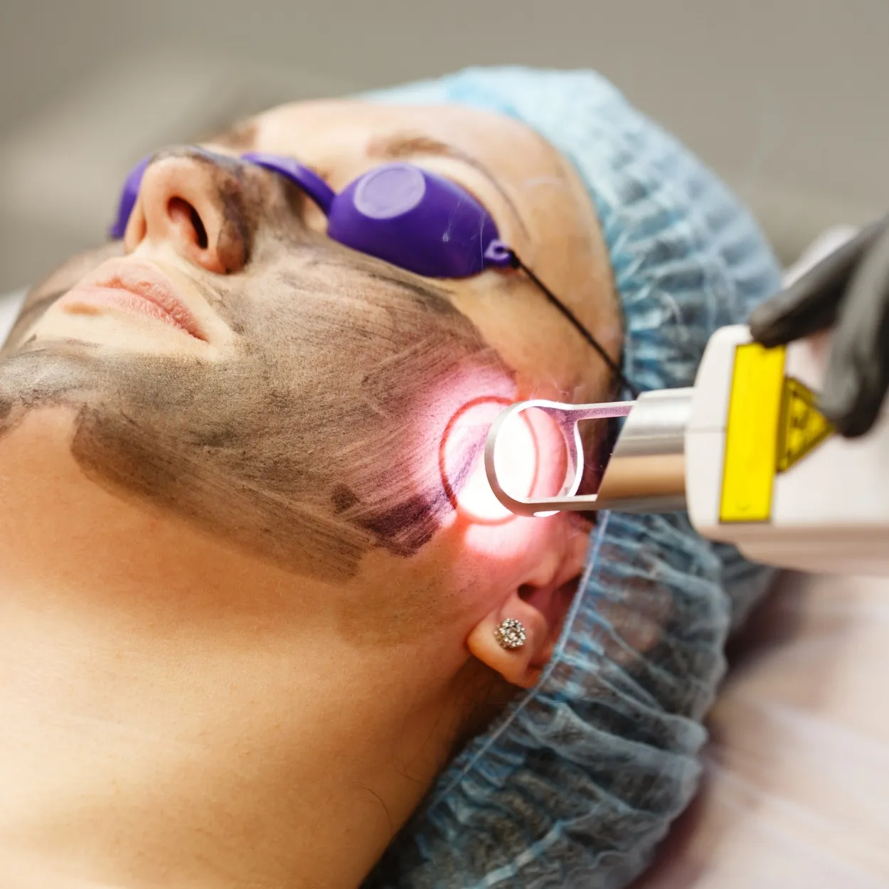 Skin & Laser Treatments