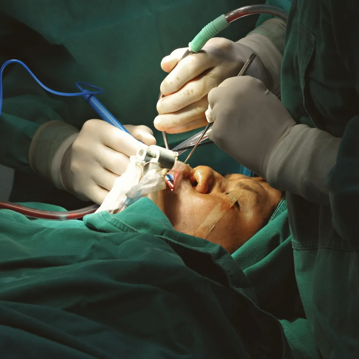 Thyroid, Breast & Endocrine Surgeries